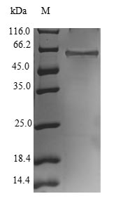 Greater than 90% as determined by SDS-PAGE.Recombinant Human E3 Ubiquitin-Protein Ligase Nrdp1 (RNF41) Protein (GST)