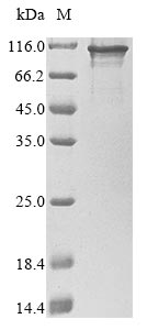 Greater than 85% as determined by SDS-PAGE.Recombinant Human Cysteine-Rich Protein 2-Binding Protein (KAT14) Protein (His)