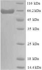 Greater than 90% as determined by SDS-PAGE.Recombinant Human Delta-Like Protein 3 (DLL3) Protein (His-SUMO)