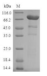 Greater than 90% as determined by SDS-PAGE.Recombinant Human Aryl-Hydrocarbon-Interacting Protein-Like 1 (AIPL1) Protein (GST)