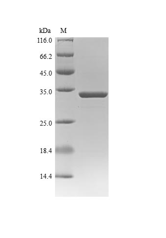 Greater than 90% as determined by SDS-PAGE.Recombinant Sudan Ebolavirus Nucleoprotein (NP) Protein (His)