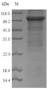Greater than 90% as determined by SDS-PAGE.Recombinant Mouse Acetyl-Coenzyme A Synthetase, Cytoplasmic Domain (ACSS2) Protein (His)