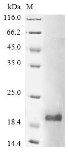 Greater than 85% as determined by SDS-PAGE.Recombinant Mouse Group 10 Secretory Phospholipase A2 (PLA2G10) Protein (His&Myc)