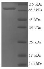 Greater than 90% as determined by SDS-PAGE.Recombinant Human Set1/Ash2 Histone Methyltransferase Complex Subunit Ash2 (ASH2L) Protein (His-SUMO)