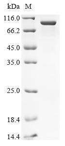 Greater than 85% as determined by SDS-PAGE.Recombinant Human Ubiquitin Thioesterase Zranb1 (ZRANB1) Protein (His&Myc)