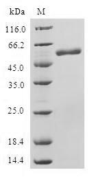 Greater than 90% as determined by SDS-PAGE.Recombinant Human Sap30-Binding Protein (SAP30BP) Protein (GST)