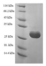Greater than 90% as determined by SDS-PAGE.Recombinant Human Trna Methyltransferase 112 Homolog (TRMT112) Protein (His-SUMO)