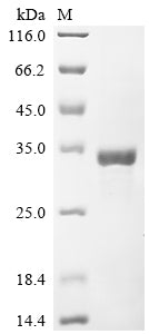 Greater than 85% as determined by SDS-PAGE.Recombinant Human Ccr4-Not Transcription Complex Subunit 7 (CNOT7) Protein (His)
