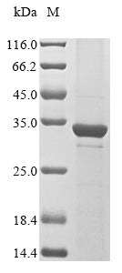 Greater than 85% as determined by SDS-PAGE.