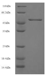 Greater than 90% as determined by SDS-PAGE.Recombinant Human Chitinase Domain-Containing Protein 1 (CHID1) Protein (His)