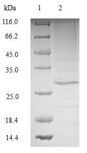 Greater than 90% as determined by SDS-PAGE.Recombinant Human Complement C1Q Tumor Necrosis Factor-Related Protein 3 (C1QTNF3) Protein (His)