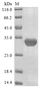 Greater than 85% as determined by SDS-PAGE.Recombinant Pig Integrin Beta-1 (ITGB1) Protein (His&Myc)
