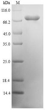 Greater than 90% as determined by SDS-PAGE.Recombinant Human Mrna-Decapping Enzyme 1A (DCP1A) Protein (His)