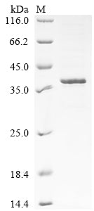 Greater than 85% as determined by SDS-PAGE.Recombinant Mouse Melanoma-Associated Antigen H1 (MAGEH1) Protein (His)