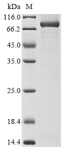 Greater than 90% as determined by SDS-PAGE.Recombinant Mouse Procollagen-Lysine,2-Oxoglutarate 5-Dioxygenase 2 (PLOD2) Protein (His-Myc)