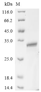 Greater than 90% as determined by SDS-PAGE.Recombinant Mouse Heme-Binding Protein 1 (HEBP1) Protein (His&Myc)