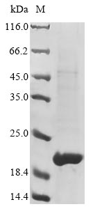 Greater than 90% as determined by SDS-PAGE.
