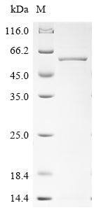 Greater than 90% as determined by SDS-PAGE.Recombinant Human Melanoma-Associated Antigen C2 (MAGEC2) Protein (His&Myc)
