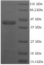 Greater than 90% as determined by SDS-PAGE.Recombinant Human Vesicle Transport Through Interaction With T-Snares Homolog 1B (VTI1B) Protein (His-SUMO)