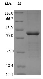Greater than 90% as determined by SDS-PAGE.Recombinant Human 5'-Amp-Activated Protein Kinase Subunit Gamma-2 (PRKAG2) Protein (His)