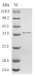 Greater than 90% as determined by SDS-PAGE.Recombinant Human Small Muscular Protein (SMPX) Protein (GST)