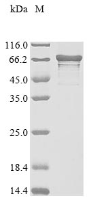 Greater than 85% as determined by SDS-PAGE.Recombinant Human La-Related Protein 6 (LARP6) Protein (His&Myc)