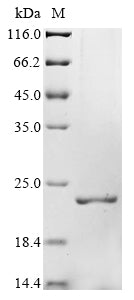 Greater than 90% as determined by SDS-PAGE.Recombinant Human Sulfiredoxin-1 (SRXN1) Protein (His&Myc)