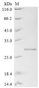 Greater than 90% as determined by SDS-PAGE.Recombinant Mouse Hepcidin (HAMP) Protein (GST)