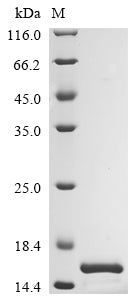 Greater than 90% as determined by SDS-PAGE.Recombinant Mouse Appetite-Regulating Hormone (GHRL) Protein (His)