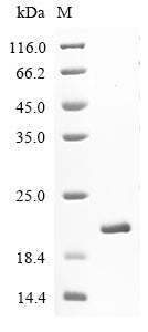 Greater than 90% as determined by SDS-PAGE.Recombinant Human Microtubule-Associated Proteins 1A/1B Light Chain 3B (MAP1LC3B) Protein (His)