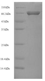 Greater than 90% as determined by SDS-PAGE.Recombinant Human Spermatogenesis-Defective Protein 39 Homolog (VIPAS39) Protein (His-SUMO)