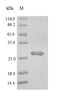 Greater than 90% as determined by SDS-PAGE.Recombinant Mouse Single Ig Il-1-Related Receptor (SIGIRR) Protein (His-SUMO)