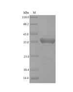 Greater than 90% as determined by SDS-PAGE.