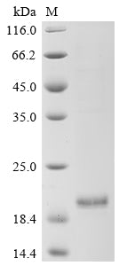 Greater than 90% as determined by SDS-PAGE.Recombinant Human Enhancer Of Yellow 2 Transcription Factor Homolog (ENY2) Protein (His)