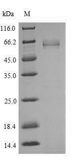 Greater than 90% as determined by SDS-PAGE.Recombinant Human Transcription Factor 7-Like 2 (TCF7L2) Protein (His)