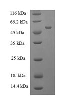 Greater than 90% as determined by SDS-PAGE.Recombinant Human Muscleblind-Like Protein 1 (MBNL1) Protein (His-SUMO)