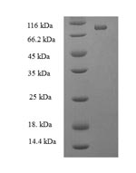 Greater than 90% as determined by SDS-PAGE.Recombinant Human Atp-Dependent Rna Helicase Ddx19A (DDX19A) Protein (His-SUMO)