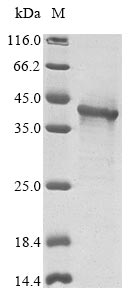 Greater than 85% as determined by SDS-PAGE.Recombinant Human Interferon Kappa (IFNK) Protein (His-SUMO)
