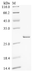 Greater than 90% as determined by SDS-PAGE.Recombinant Human Interferon Kappa (IFNK) Protein (His&Myc)