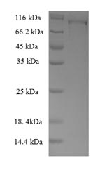 Greater than 90% as determined by SDS-PAGE.Recombinant Human Methionine Synthase Reductase (MTRR) Protein (GST)