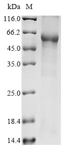 Greater than 85% as determined by SDS-PAGE.Recombinant Human Zinc Finger Ccch Domain-Containing Protein 7B (ZC3H7B) Protein (His&Myc)