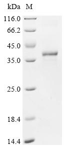 Greater than 85% as determined by SDS-PAGE.Recombinant Human Npc1-Like Intracellular Cholesterol Transporter 1 (NPC1L1) Protein (His&HA)