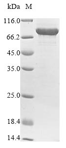 Greater than 85% as determined by SDS-PAGE.Recombinant Human Protein-Arginine Deiminase Type-4 (PADI4) Protein (His&Myc)