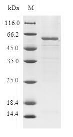 Greater than 90% as determined by SDS-PAGE.Recombinant Human Trans-1,2-Dihydrobenzene-1,2-Diol Dehydrogenase (DHDH) Protein (GST)