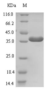 Greater than 90% as determined by SDS-PAGE.Recombinant Human E3 Ubiquitin-Protein Ligase Znrf3 (ZNRF3) Protein (His-SUMO)