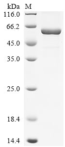 Greater than 85% as determined by SDS-PAGE.Recombinant Human 7-Alpha-Hydroxycholest-4-En-3-One 12-Alpha-Hydroxylase (CYP8B1) Protein (His)