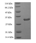 Greater than 90% as determined by SDS-PAGE.Recombinant Human Group Iid Secretory Phospholipase A2 (PLA2G2D) Protein (His-SUMO)