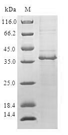 Greater than 90% as determined by SDS-PAGE.Recombinant Human Peroxisomal Carnitine O-Octanoyltransferase (CROT) Protein (GST)