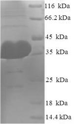 Greater than 90% as determined by SDS-PAGE.Recombinant Human Protein Argonaute-2 (AGO2) Protein (His)