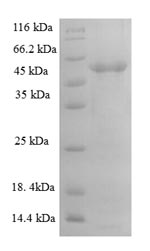 Greater than 90% as determined by SDS-PAGE.Recombinant Human A Disintegrin And Metalloproteinase With Thrombospondin Motifs 7 (ADAMTS7) Protein (His-SUMO)